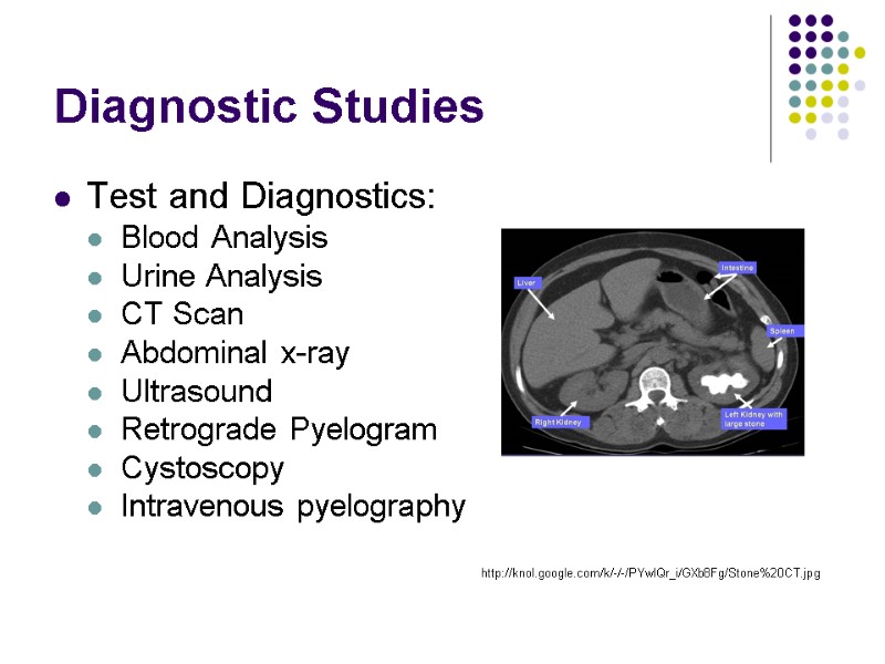 Diagnostic Studies Test and Diagnostics: Blood Analysis Urine Analysis CT Scan Abdominal x-ray Ultrasound
